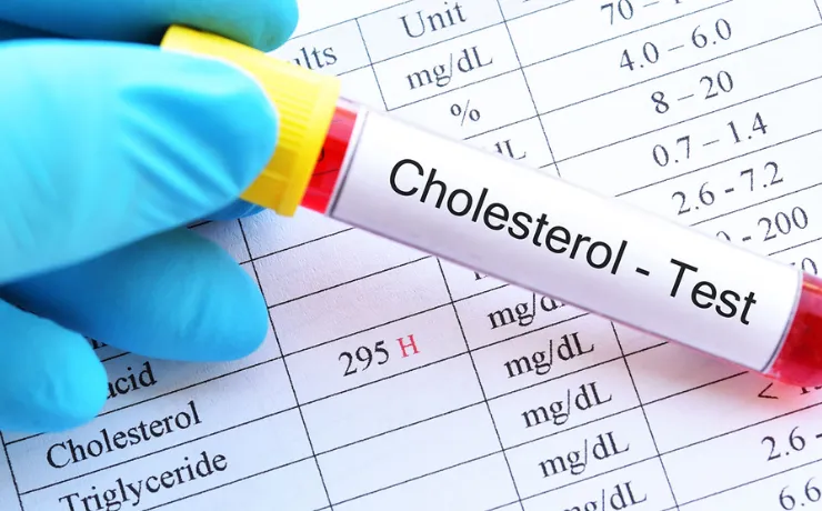 Cholesterol FAQ – What Readers Are Searching For and What You Should Know