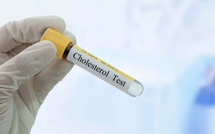 Managing High Cholesterol with Lifestyle Changes and Medication